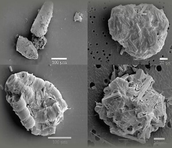 Microzooplankton poo