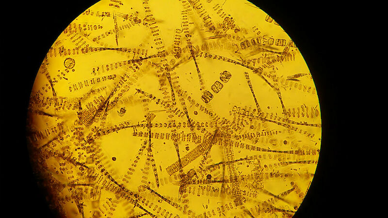 Sea ice diatoms viewed through a microscope