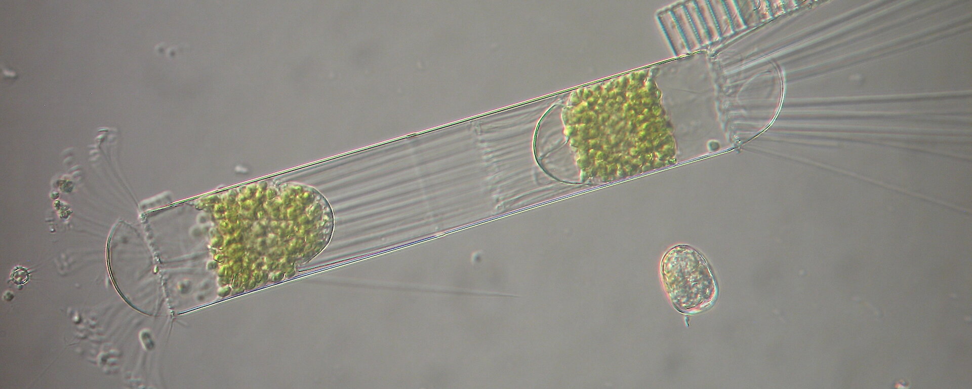 Microscope slide of dividing phytoplankton cell