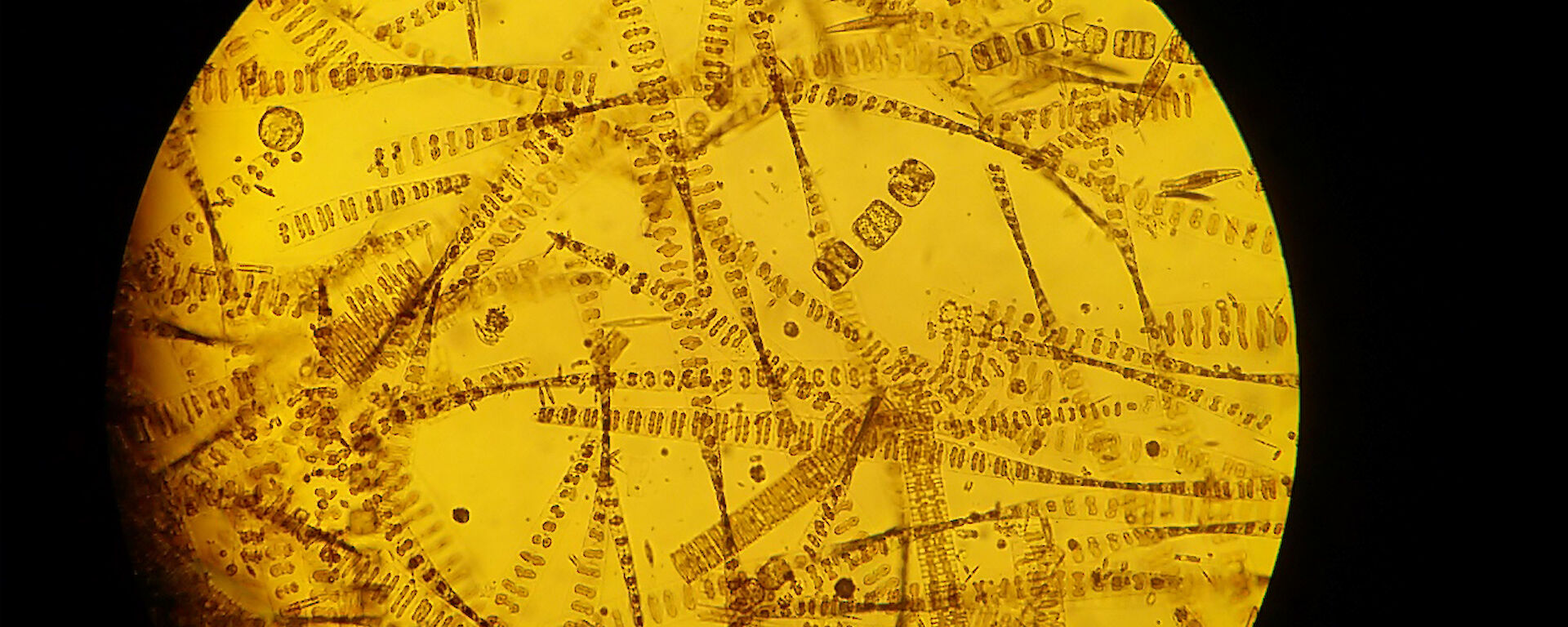 A microscopic view of sea ice diatoms collected from fast-ice cores. These algae have silicate frustules and form colonies and chains, and are adapted to the low light conditions under the ice.