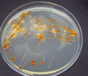 This sea-ice bacteria, Psychroflexus torquis, growing on an agar plate, forms proteorhodopsins.