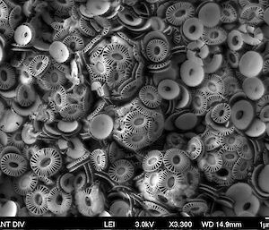 Microscopic image of coccolithophorids that look like bunches of corn pads