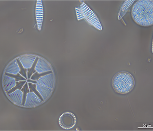 A diatom assemblage captured by one of the traps (61 degrees south) as viewed under phase contrast illumination on a light microscope