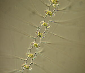 This chain-forming diatom is a component of the Southern Ocean phytoplankton. It consists of seven individual cells joined together, to increase their surface area, and the golden brown colour within each cell is the chlorophyll that is measured from space.