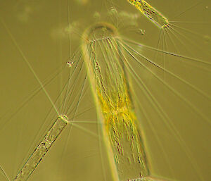 Microscopic image of a diatom, Corethron, which is about 0.1mm long.