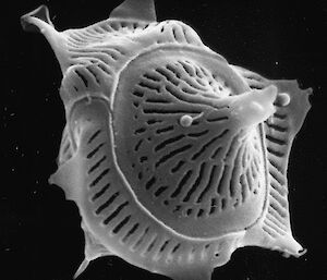 Scanning electron micrograph of a species of Parmales