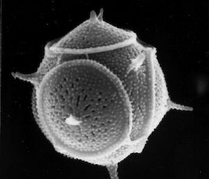 Scanning electron micrograph of a species of Parmales. These organisms are covered in distinctively pattered silica scales. They are about 4 µm in diameter.