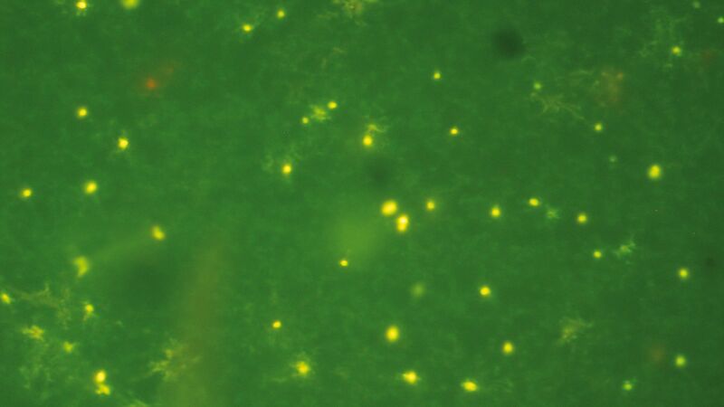 A fluorescence microscope image of cyanobacteria. Each cell is about 1 µm (0.001mm) in diameter.