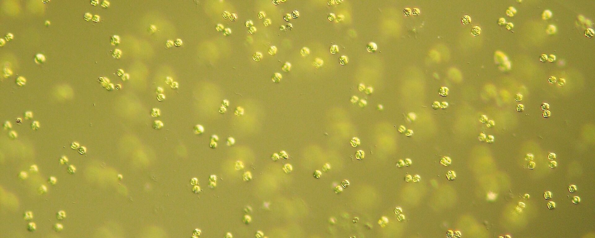 Colonies of the alga Phaeocystis can be several centimetres in diameter and contain thousands of individual cells which are about 5 µm in diameter.