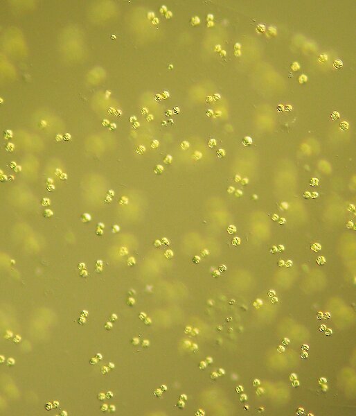 Colonies of the alga Phaeocystis can be several centimetres in diameter and contain thousands of individual cells which are about 5 µm in diameter.