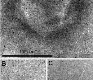 Transmission electron micrographs of virus-like particles from Organic Lake resembling (A) phycodnavirus or PV, (B) Sputnik virophage, (C) bacteriophage – a virus that infects bacteria.