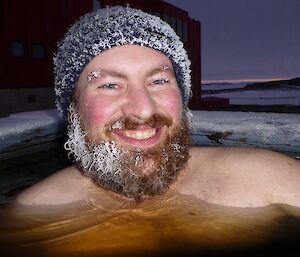 Expeditioner in the spa with ice forming on his beanie, beard and eyebrows