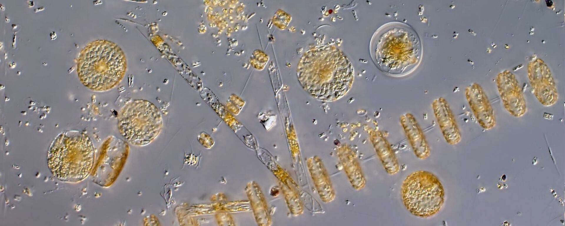 Phytoplankton cells