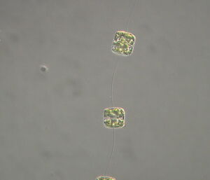 Phytoplankton cells