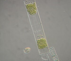 A dividing phytoplankton cell from the Corethron genus.