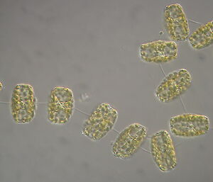 A chain of phytoplankton viewed under a light microscope.