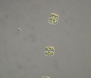 A chain of phytoplankton cells from the Thalassiosira genus.