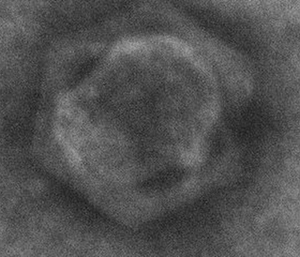 Transmission electron micrograph of a negatively stained virus-like particle from Organic Lake which resembles a phycodnavirus or PV.