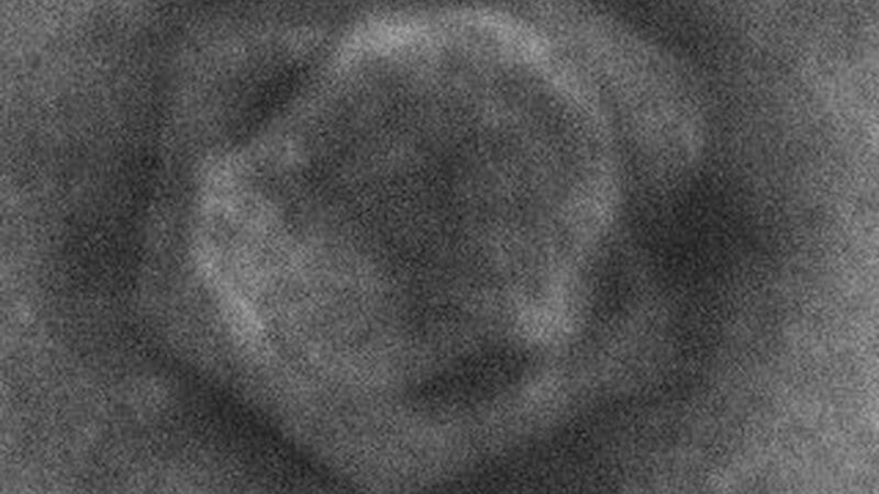 Transmission electron micrograph of a negatively stained virus-like particle from Organic Lake which resembles a phycodnavirus or PV.