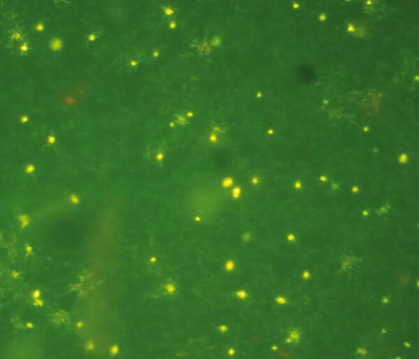 A fluorescence microscope image of cyanobacteria. Each cell is about 1 µm (0.001mm) in diameter.