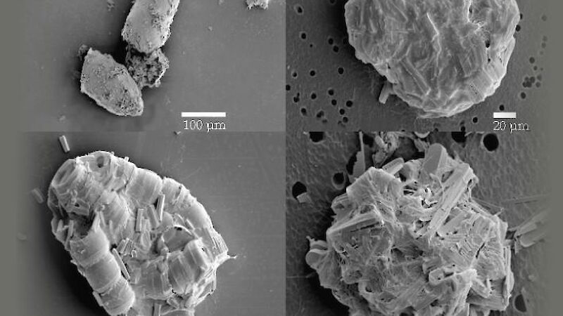 Microzooplankton poo