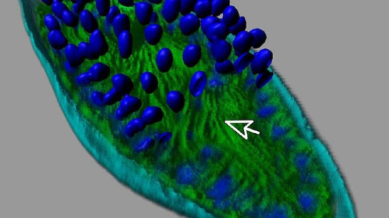 A green phytoplankton cell covered with round blue spores.