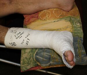 Steve Edwards broken ankle at Davis 2012