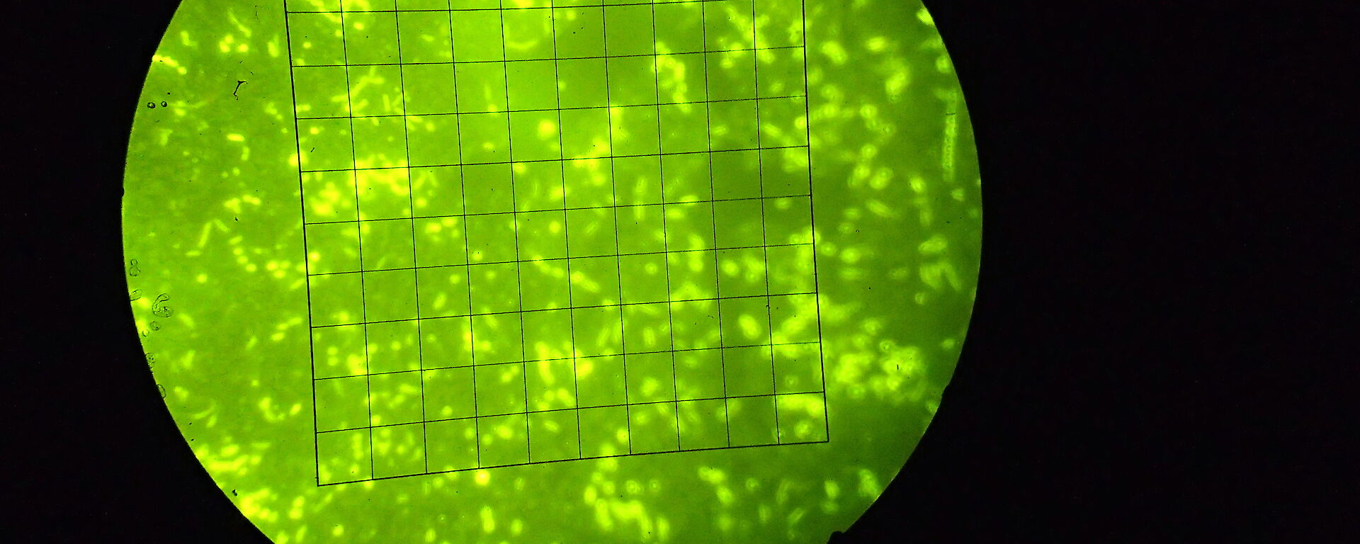 ) florescent green dots and squiggles on a slide