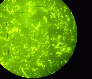 ) florescent green dots and squiggles on a slide