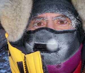 Darron Lehmann close up of face covered in ice