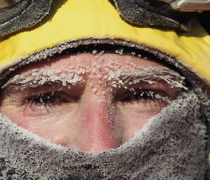 A closeup of the icicles frozen to Steve’s face