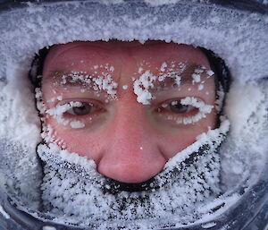 An expeditioner’s face covered in snow and ice.