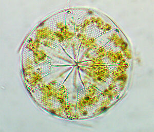 A photo of a phytoplankton taken under a microscope. It is round in shape.