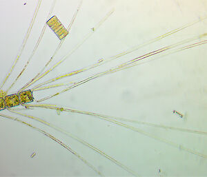 Another phytoplankton picture taken from under a microscope. This one is rectangular with long tendrils coming off it.