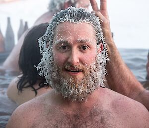 Bryce with an icy beard in the hot tub.