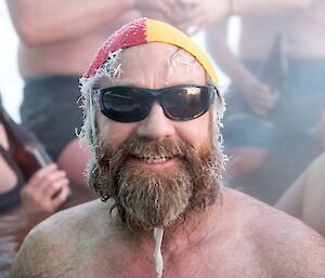 Fitzy in the hot tub.