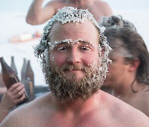 Jock with an icy beard in the hot tub.