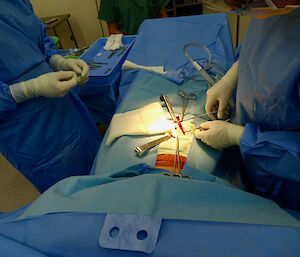 Mock appendicitis surgery training