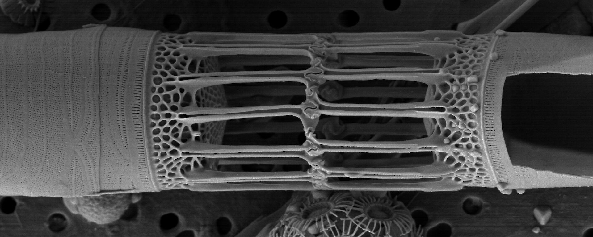 Electron microscope image of coccolithophorids