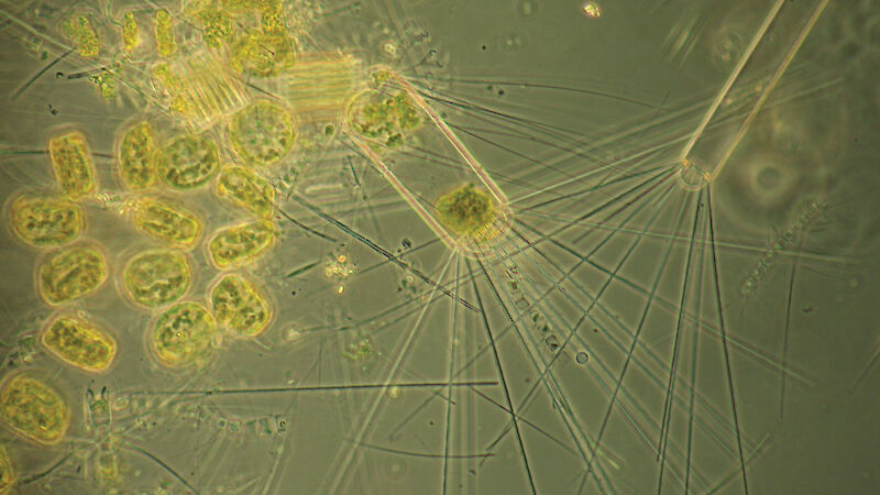 Image seen through microscope of tiny phytoplankton shapes