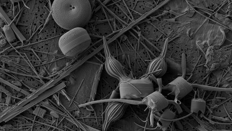 Electron microscope image of phytoplankton