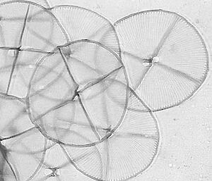 Transmission electron micrograph image showing the internal details of a rounded cell.