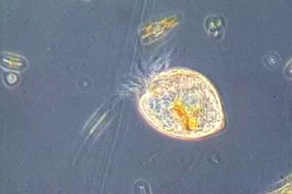 ciliates under microscope