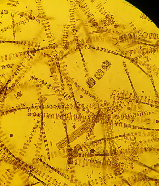 A microscopic view of sea ice diatoms collected from fast-ice cores. These algae have silicate frustules and form colonies and chains, and are adapted to the low light conditions under the ice.