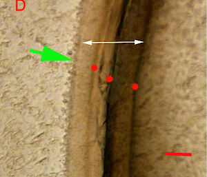 Annual growth bands indicated by dots in this eyestalk show the krill was three years old. Scale bar indicates 20 µm.
