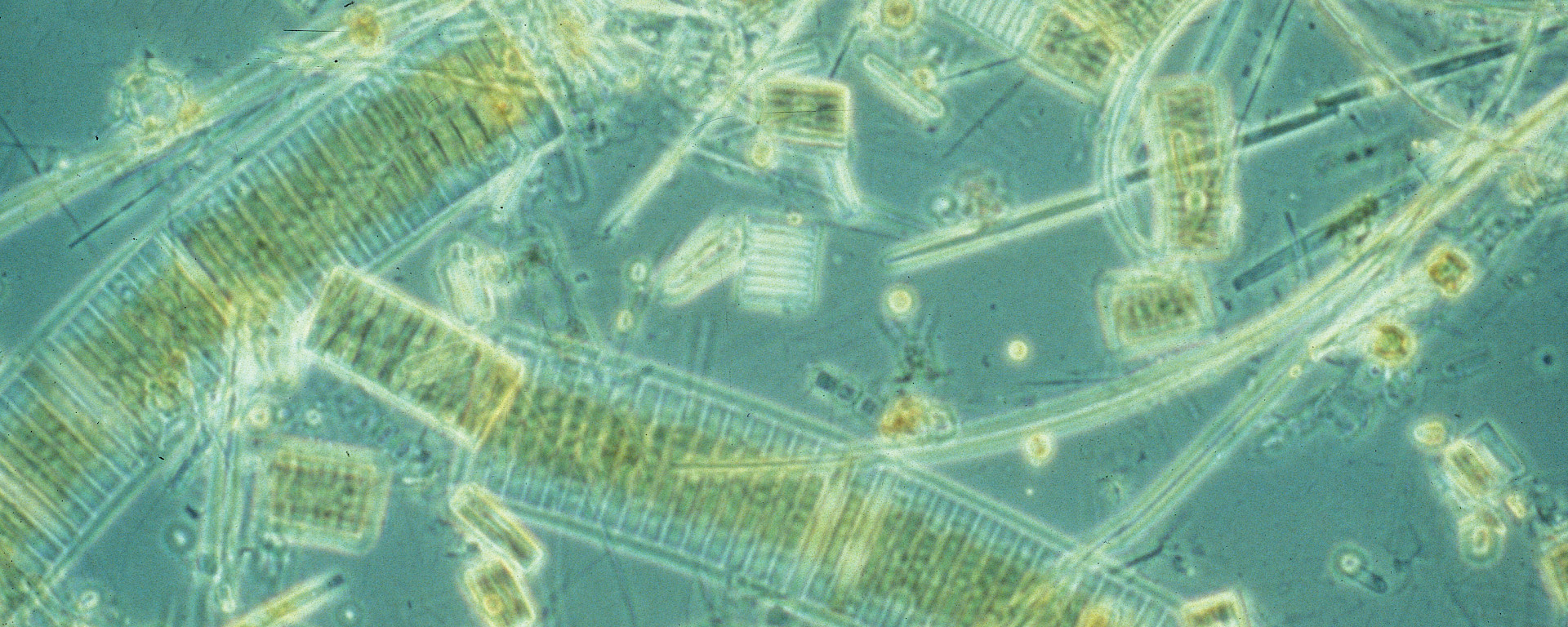 Micrograph of phytoplankton