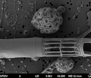 Microscopic image of coccolithophorid