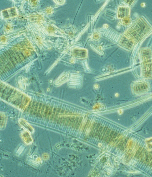 Micrograph of phytoplankton