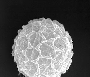 Electron microscope image of snow algae