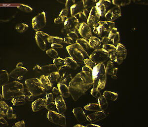 Microscopic image looks like small golden pebbles against a black background.